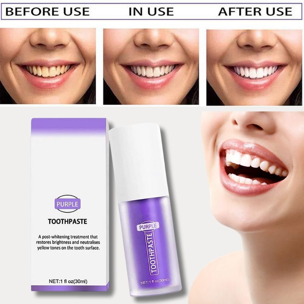 Rnlrclrl Purple Toothpaste for Effective Teeth Whitening and Stain Removal - Foam Formula